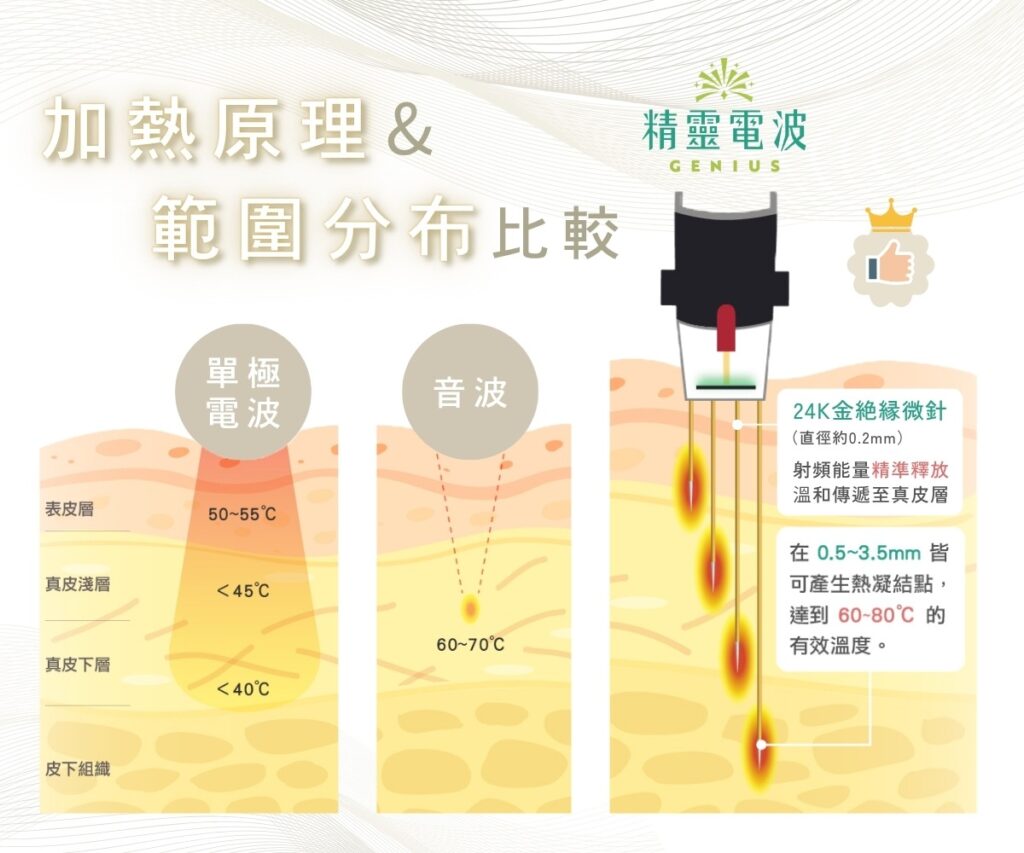 精靈電波GENIUS加熱原理比較圖：單極電波、音波、24K金絕緣微針，有效溫度達60~80℃。