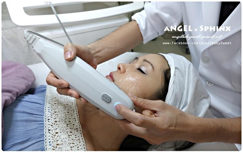 技師正在進行Ultherapy（音波拉提）治療。該設備被放置在患者的臉上。