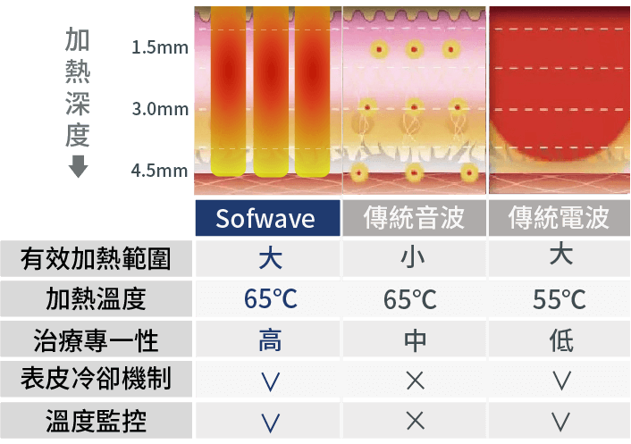 比較表:Sofwave 與傳統超音波和射頻緊膚療法。顯示加熱深度和其他主要差異。 包含關鍵字:音波拉提、鳳凰電波