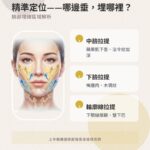 埋線拉提區域解析圖：中臉、下臉、輪廓線拉提說明，針對蘋果肌下垂、法令紋、嘴邊肉、雙下巴等問題。