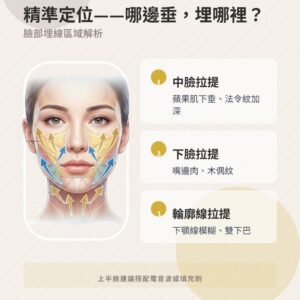 埋線拉提價格、後遺症、品牌全解析｜MINT、藍鑽、少女線比較懶人包