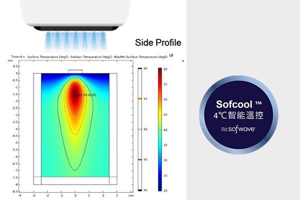 Sofcool™ 技術:4°C 降溫效果。溫度分佈圖顯示治療過程中的有效降溫效果。