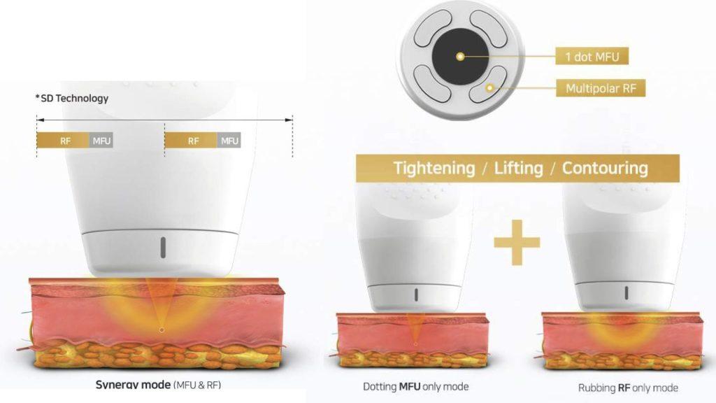圖表顯示了 Synerav 模式、僅 Dotting MFU 模式和僅 Rubbing RF 模式，用於緊緻和提升皮膚。