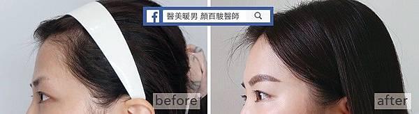 晶亮瓷豐額效果