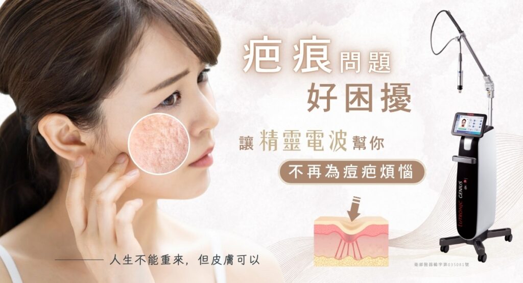 痘疤困擾？精靈電波GENIUS幫你解決！ Lutronic Genius儀器與皮膚剖面圖。