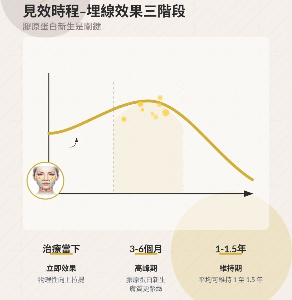 埋線拉提效果圖示：治療當下立即見效，3-6個月達高峰，可維持1-1.5年。膠原蛋白新生是關鍵。
