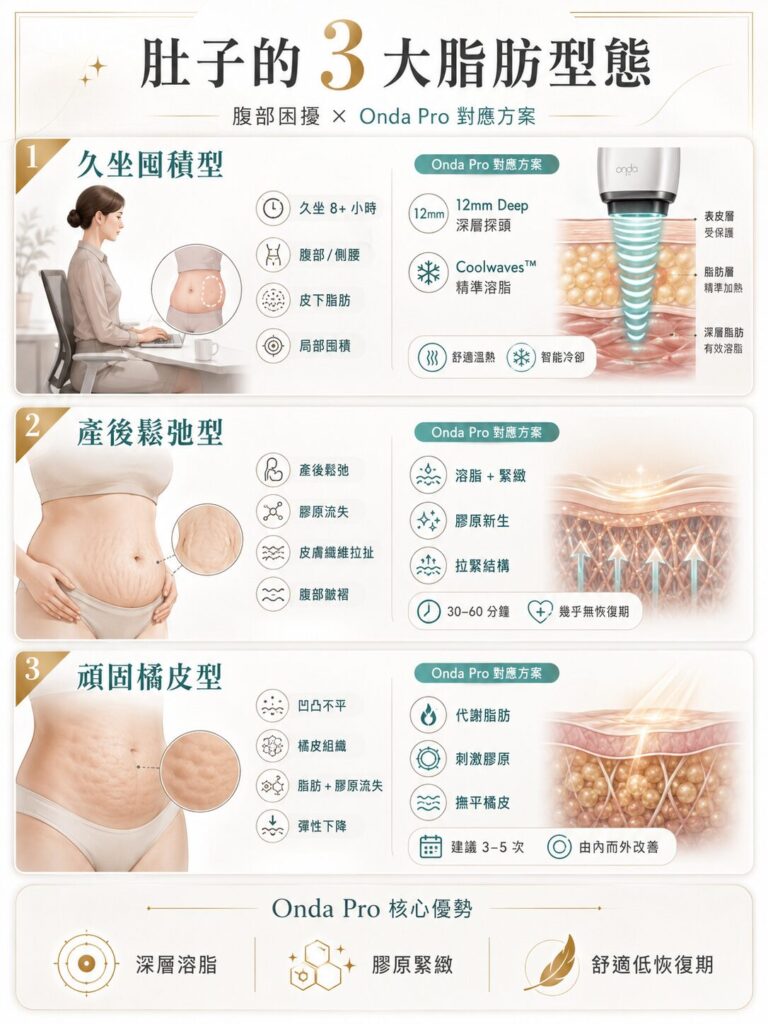 Onda Pro 肚皮3大脂肪剋星:久坐囤積、產後鬆弛、頑固橘皮,超微波溶脂緊緻肌膚