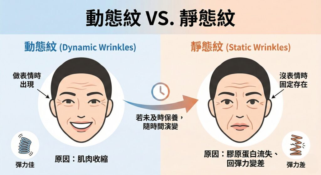 眼周紋路圖解：動態紋（表情時出現，肌肉收縮）與靜態紋（固定存在，膠原蛋白流失）。