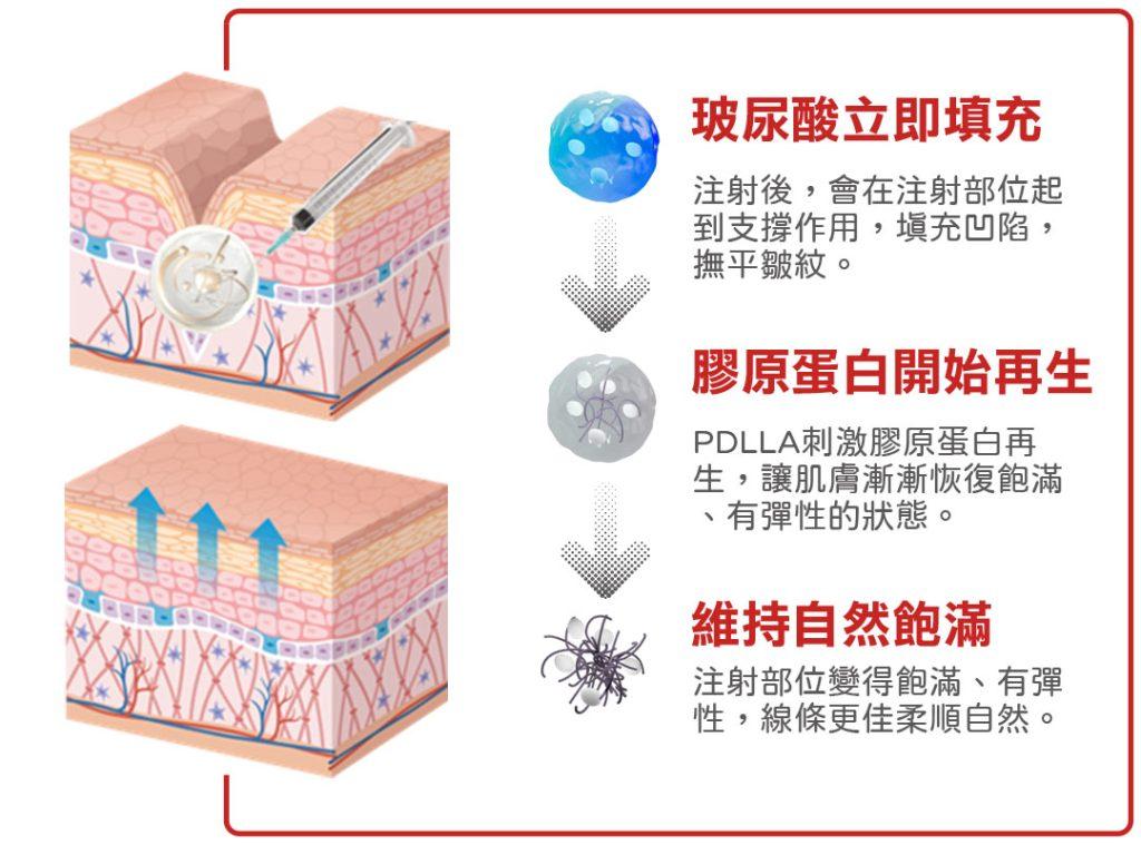 玻尿酸 膠原蛋白