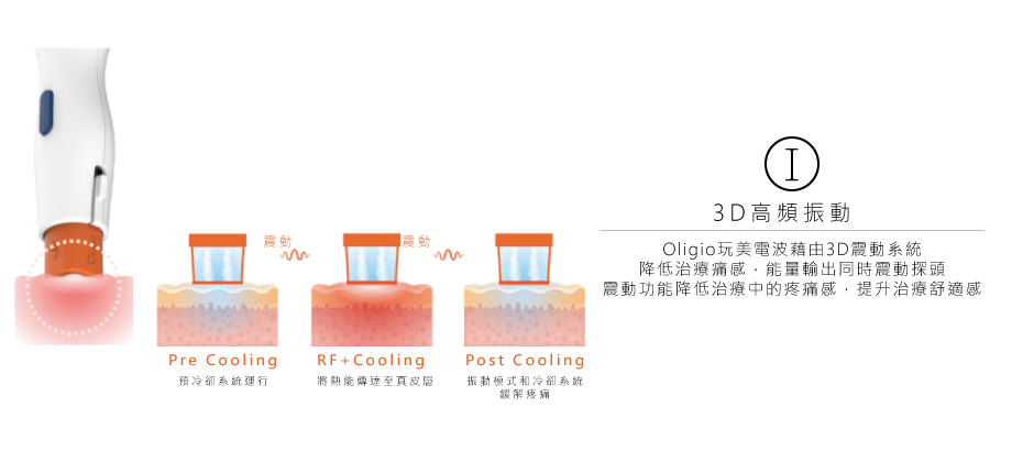 圖示為皮膚護理的3D高頻振動技術。圖中展示了預冷卻、射頻冷卻和後冷卻階段。