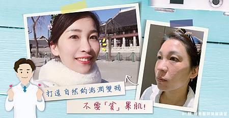 蘋果肌位置示意圖與蘋果肌凹陷對比。