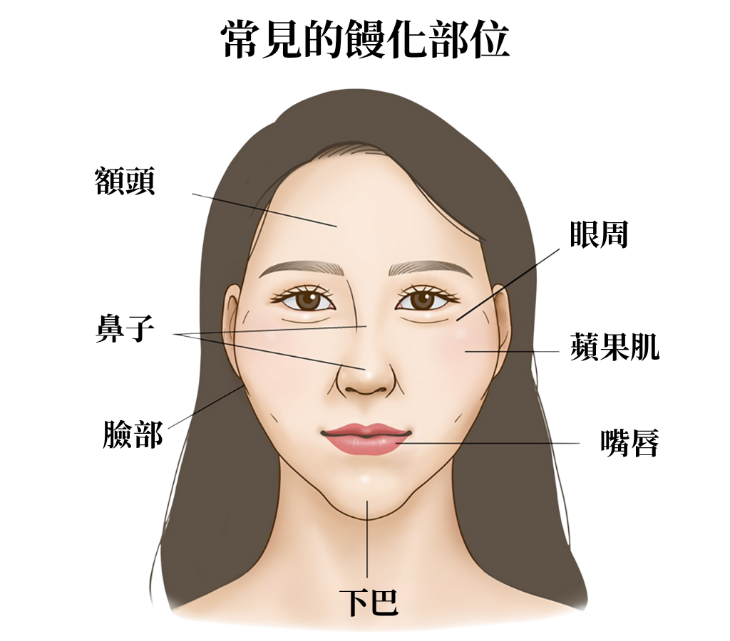 臉部示意圖,標示下巴。臉部微整參考,預防饅化臉。