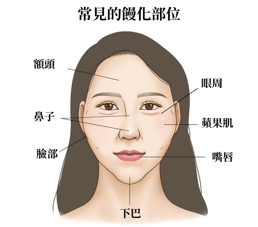 臉部結構圖，標示額頭、眼睛、鼻子、蘋果肌、嘴唇、下巴等部位。臉部微整醫美參考。