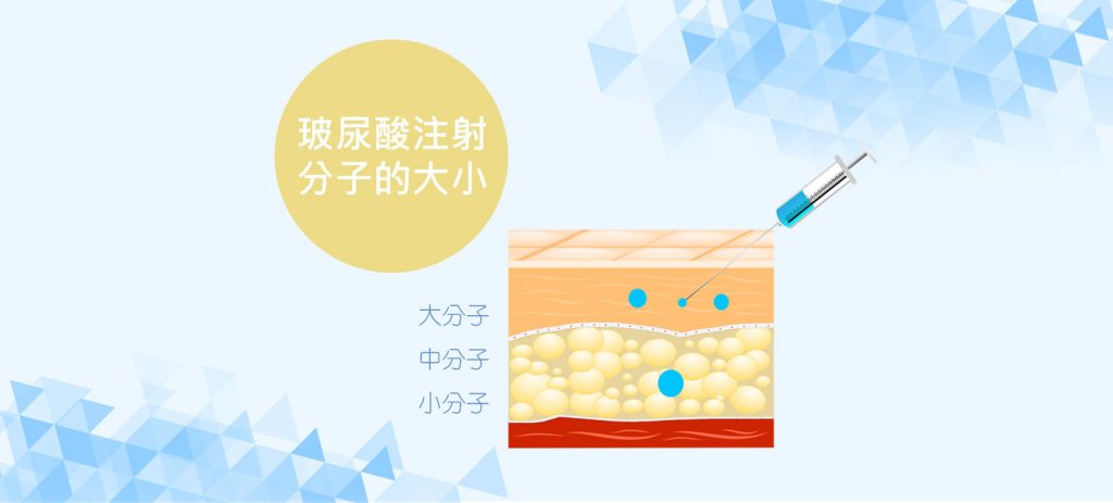 顯示透明質酸分子大小和注射到皮膚層的圖表。 玻尿酸注射液