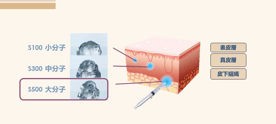 顯示透明質酸分子大小(S100、S300、S500)及其註入皮膚層(表皮層、真皮層、皮下組織)的深度的圖表。