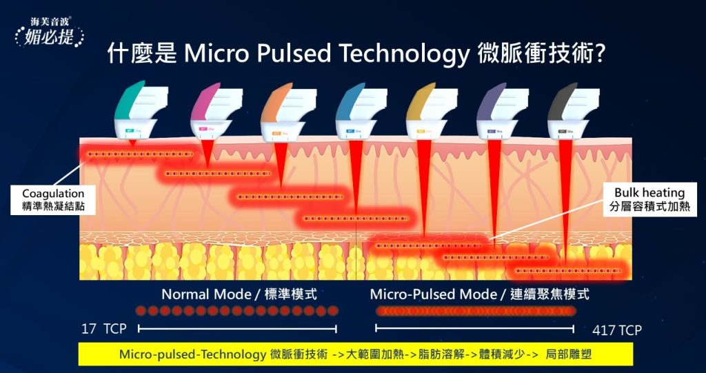 圖表比較了微脈衝技術與皮膚治療的標準模式，顯示了凝固和整體加熱效果。 417 TCP 與 17 TCP。