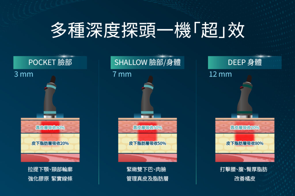 ONDA PRO 超微波儀器針對不同深度皮膚層顯示，從上到下分別是80%、50%和20%