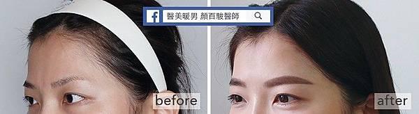 晶亮瓷豐額