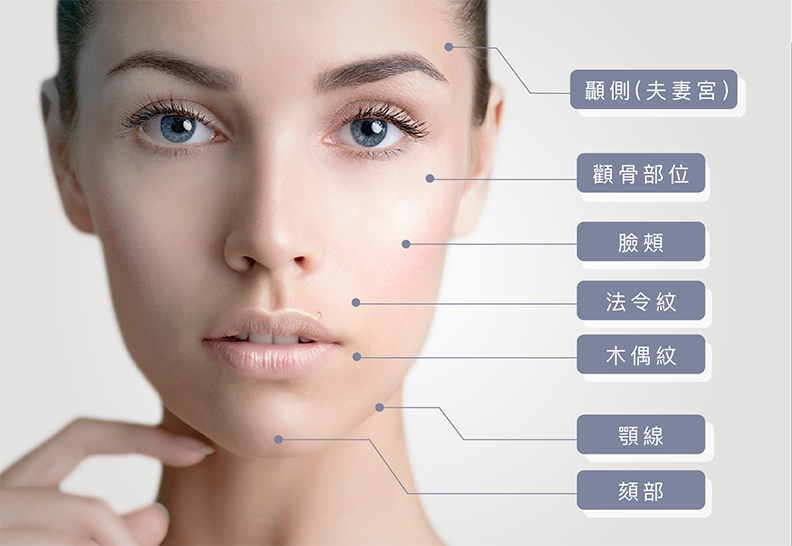 此圖顯示了受老化影響的臉部區域，包括臉頰、下顎線和額頭。圖中展示了Ultherapy（音波拉提）等療法的目標區域。